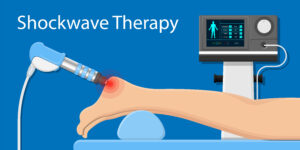 Shock Wave Therapy