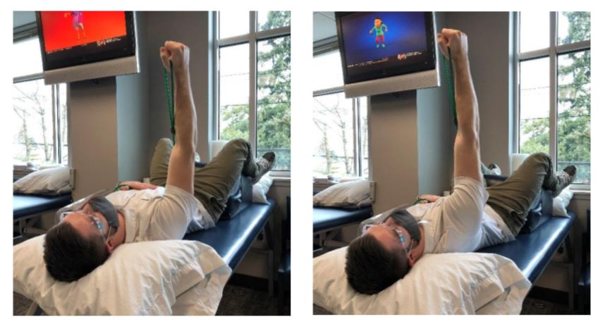  scapula winging therapy
