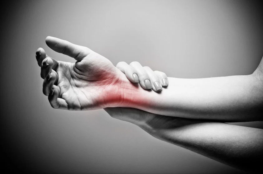 Nerve Injuries in the Arm