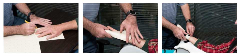 hand therapist in Armworks Hand Therapy bevearton