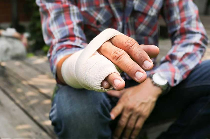 custom splint after a fracture injury
