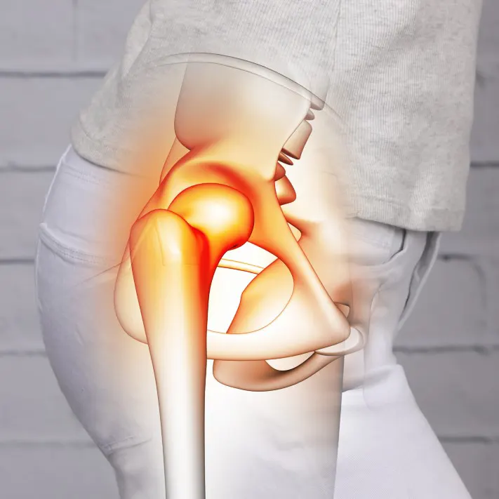 Hip Pain Conditions We Treat